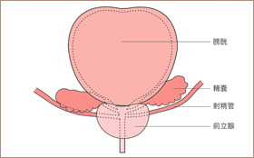 前立腺肥大症解剖図