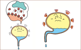 過活動膀胱