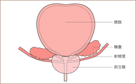 前立腺肥大症